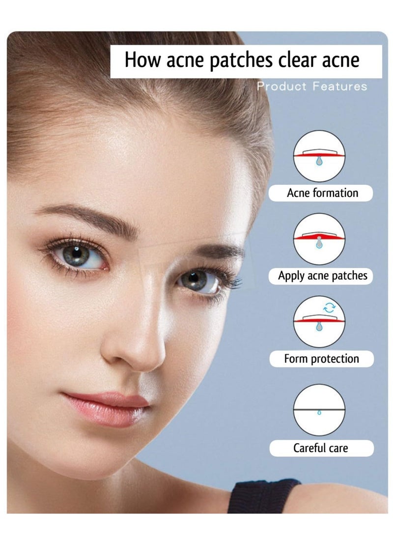 Multi-shaped acne patches, gentle on the face, hydrocolloid overnight acne-absorbing patches | Lightweight, waterproof treatment patches for all skin types (24 to 36 patches per pack) - Image 1